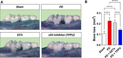 The impact of the soluble epoxide hydrolase cascade on periodontal tissues